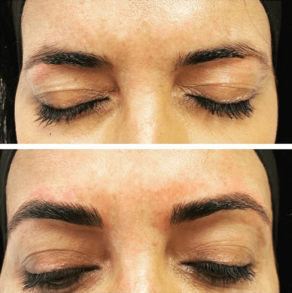 Before and after brow treatment with eyes closed