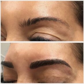 Before and after brow treatment showing fuller, darker brows